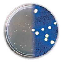 Conventional (left) vs. Milliflex® Rapid Image Analysis (right)